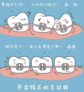 牙齒矯正12.png